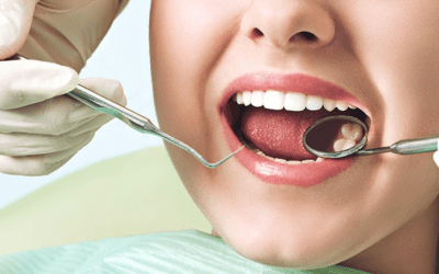 Cost of Dental Sealants: What to Expect